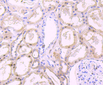 FKBP51 Recombinant Rabbit Monoclonal Antibody