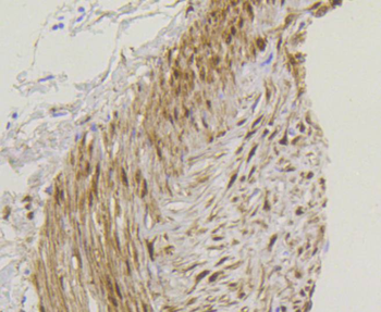 YAP1 Recombinant Rabbit Monoclonal Antibody