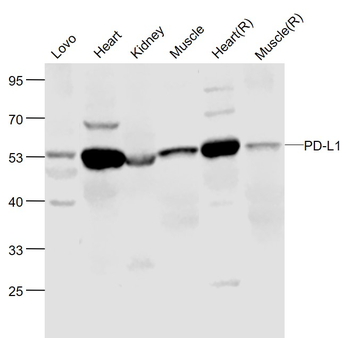 PD-L1 Rabbit Polyclonal Antibody
