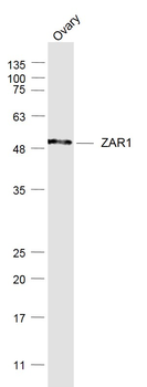ZAR1 Rabbit Polyclonal Antibody