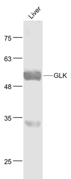 GLK Rabbit Polyclonal Antibody