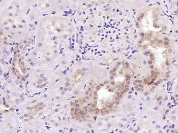 TBX3 Rabbit Polyclonal Antibody