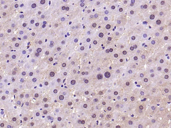 TBX3 Rabbit Polyclonal Antibody
