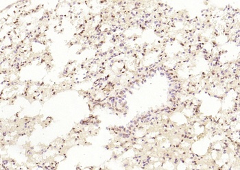HDAC7 (phospho-Ser358) antibody