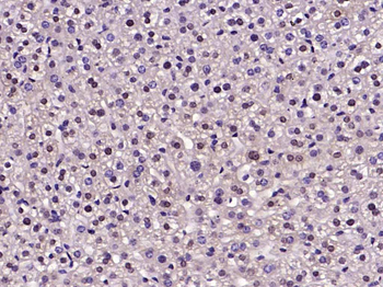 Nur77 Rabbit Polyclonal Antibody