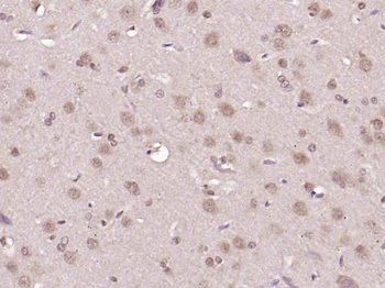 Nur77 Rabbit Polyclonal Antibody
