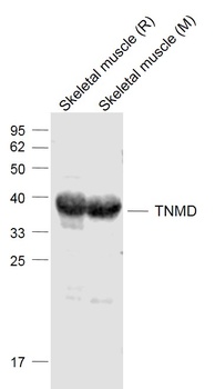 TNMD antibody