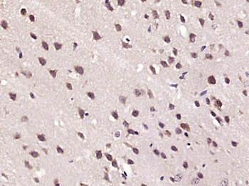 HDAC10 Rabbit Polyclonal Antibody