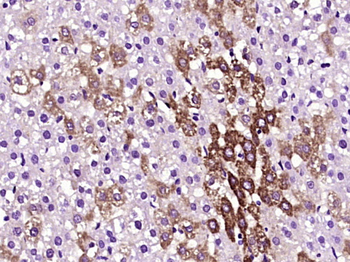 HDAC10 Rabbit Polyclonal Antibody