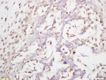 HDAC11 Rabbit Polyclonal Antibody