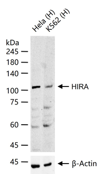 HIRA Rabbit Polyclonal Antibody