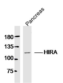 HIRA Rabbit Polyclonal Antibody