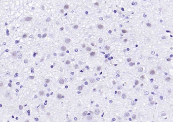 Histone H2B/HIST1H2BD Rabbit Polyclonal Antibody