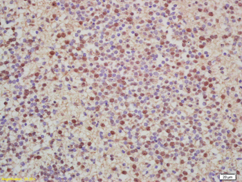 Histone H2A/H2A.1 Rabbit Polyclonal Antibody