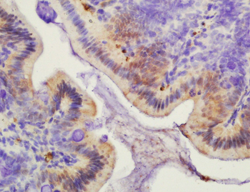 Histone H2A/H2A.1 Rabbit Polyclonal Antibody