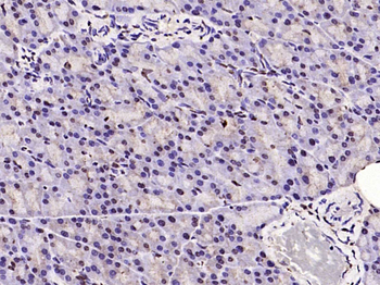 Histone H3 (Acetyl K23) Rabbit Polyclonal Antibody