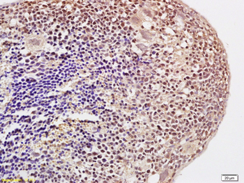 Histone H3 (Acetyl K23) Rabbit Polyclonal Antibody