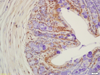 Histone H2B (Acetyl K20) Rabbit Polyclonal Antibody