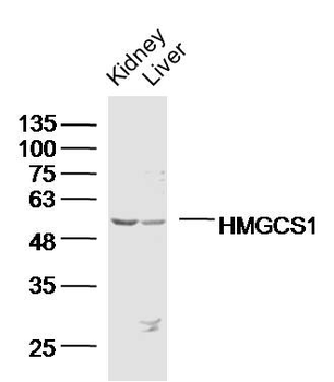 HMGCS1 Rabbit Polyclonal Antibody