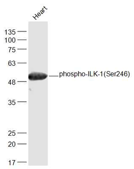 Phospho-ILK-1 (Ser246) Rabbit Polyclonal Antibody