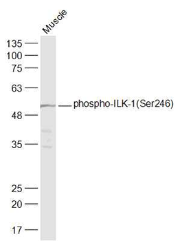 Phospho-ILK-1 (Ser246) Rabbit Polyclonal Antibody