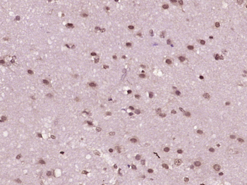 Phospho-IRAK1 (Ser376) Rabbit Polyclonal Antibody