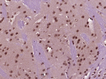Phospho-IRAK1 (Ser376) Rabbit Polyclonal Antibody