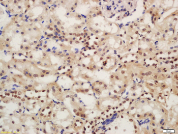 Phospho-IRAK1 (Ser376) Rabbit Polyclonal Antibody