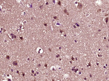 Phospho-IRAK1 (Thr387) Rabbit Polyclonal Antibody
