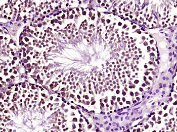 Phospho-IRAK1 (Thr387) Rabbit Polyclonal Antibody