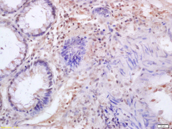 IRF3 Rabbit Polyclonal Antibody