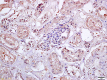 IRF3 Rabbit Polyclonal Antibody