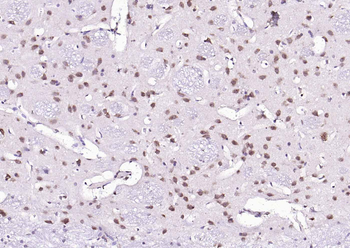 KAT2B Rabbit Polyclonal Antibody