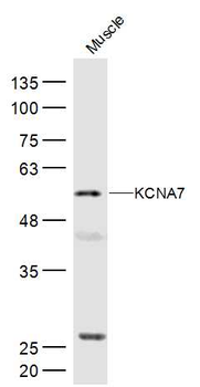 KCNA7 Rabbit Polyclonal Antibody