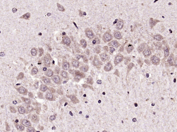 KEAP1 Rabbit Polyclonal Antibody