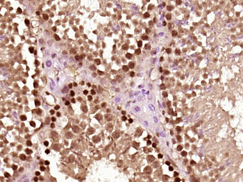 Kinesin 5B Rabbit Polyclonal Antibody