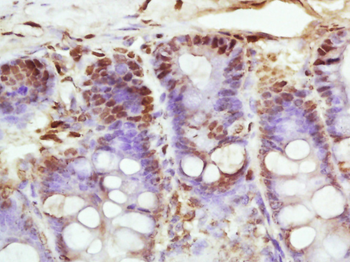 Kinesin 5B Rabbit Polyclonal Antibody