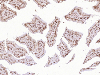 Phospho-KLF5 (Ser311) Rabbit Polyclonal Antibody
