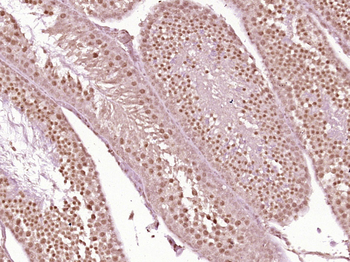 Phospho-KLF5 (Ser311) Rabbit Polyclonal Antibody