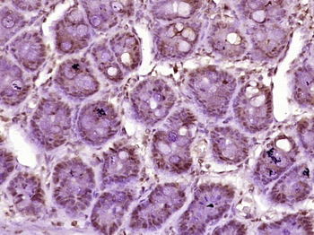 Phospho-KLF5 (Ser311) Rabbit Polyclonal Antibody