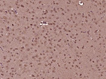 KLF8 Rabbit Polyclonal Antibody