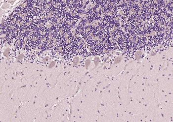 Mu Opioid receptor Rabbit Polyclonal Antibody