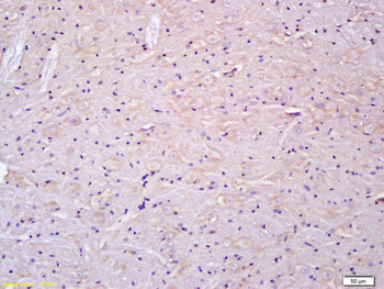 Delta Opioid Receptor Rabbit Polyclonal Antibody