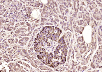 KSR1 Rabbit Polyclonal Antibody