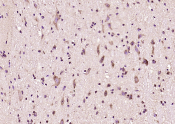 KSR1 Rabbit Polyclonal Antibody