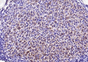 Stathmin (phospho-Ser16) antibody