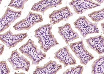 LASS5 Rabbit Polyclonal Antibody