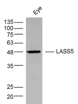 LASS5 Rabbit Polyclonal Antibody