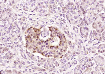 LASS6 Rabbit Polyclonal Antibody