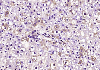 Phospho-LATS1 (Ser909) Rabbit Polyclonal Antibody